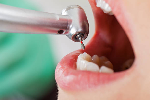 Best Emergency Treatment for Toothache in Cowpens, SC